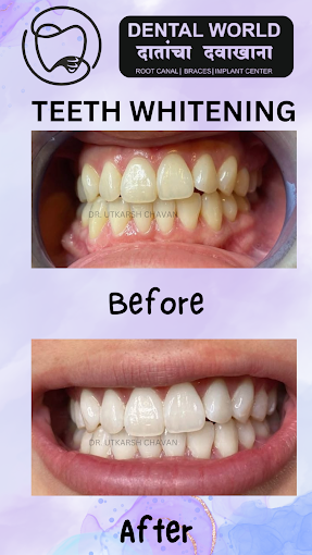 Dental World Dental clinic in Punawale