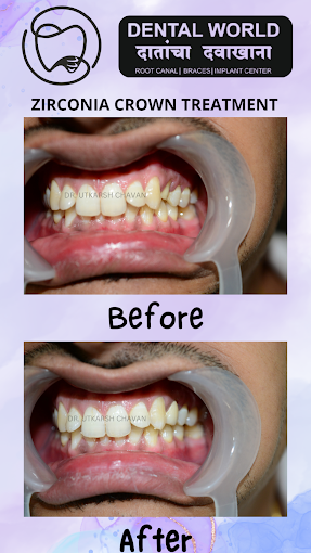 Dental World Dental clinic in Punawale