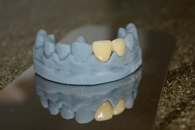 Dental World Dental clinic in Punawale